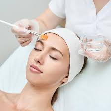 Chemical Peel pic for website