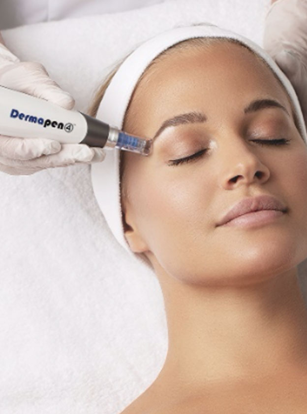 Skin Needling website pic